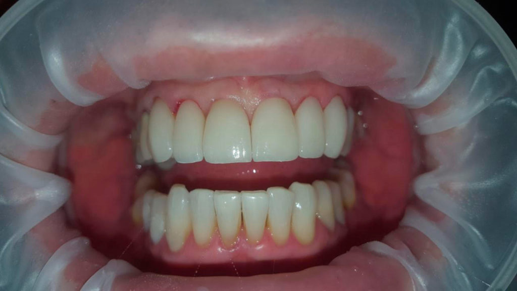 Odontología Estética 1