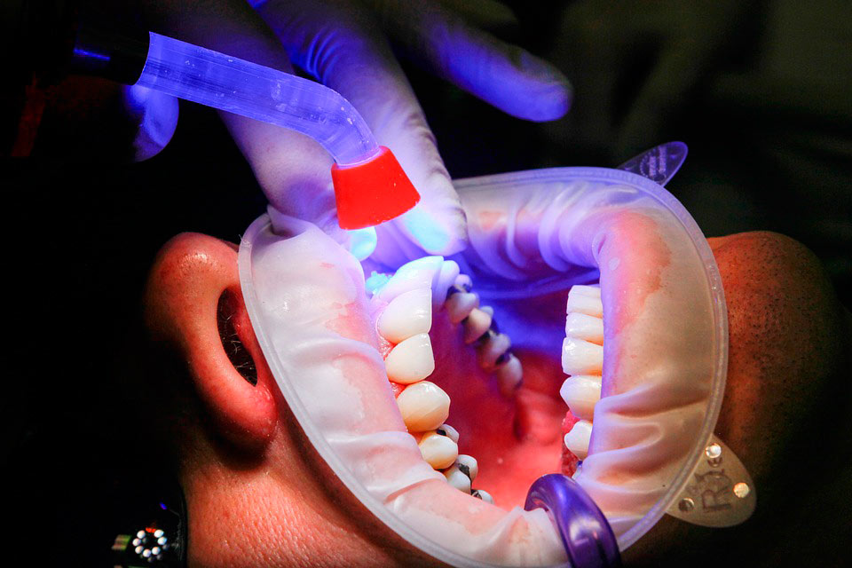 Odontología estética