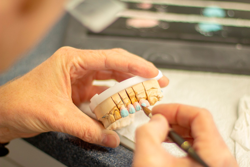 Rehabilitación Oral 1
