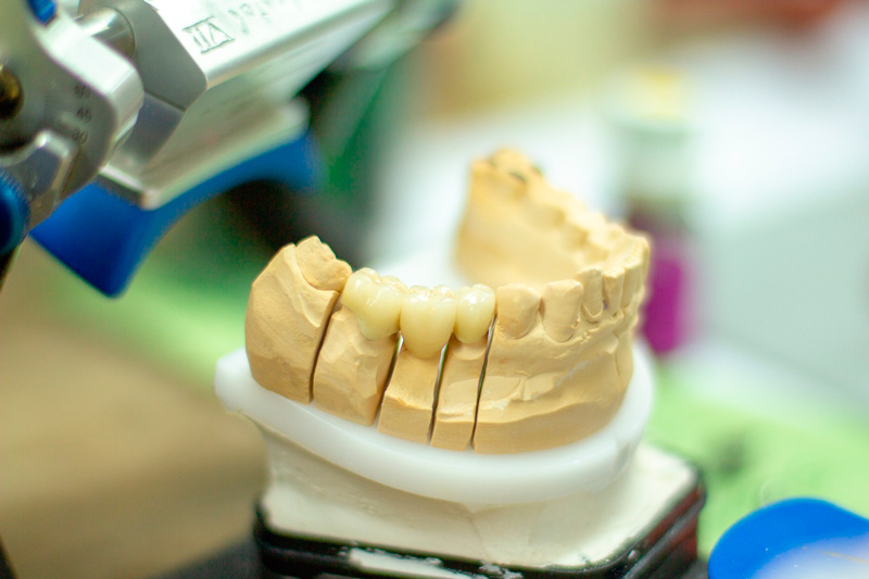 Rehabilitación Oral
